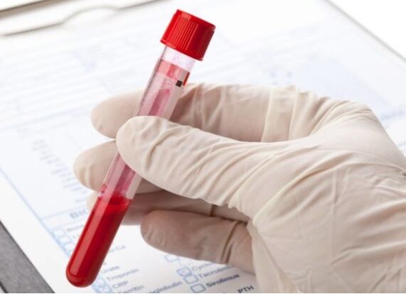 I metodi diagnostici di laboratorio consentono di identificare la microflora o il virus patologico