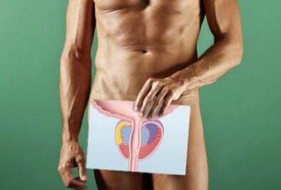 Cambiare la prostata con la prostatite